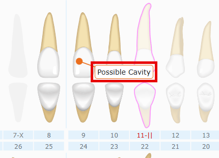 ALTC2.png