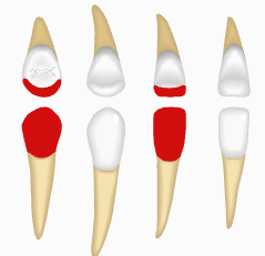 OPO6.png