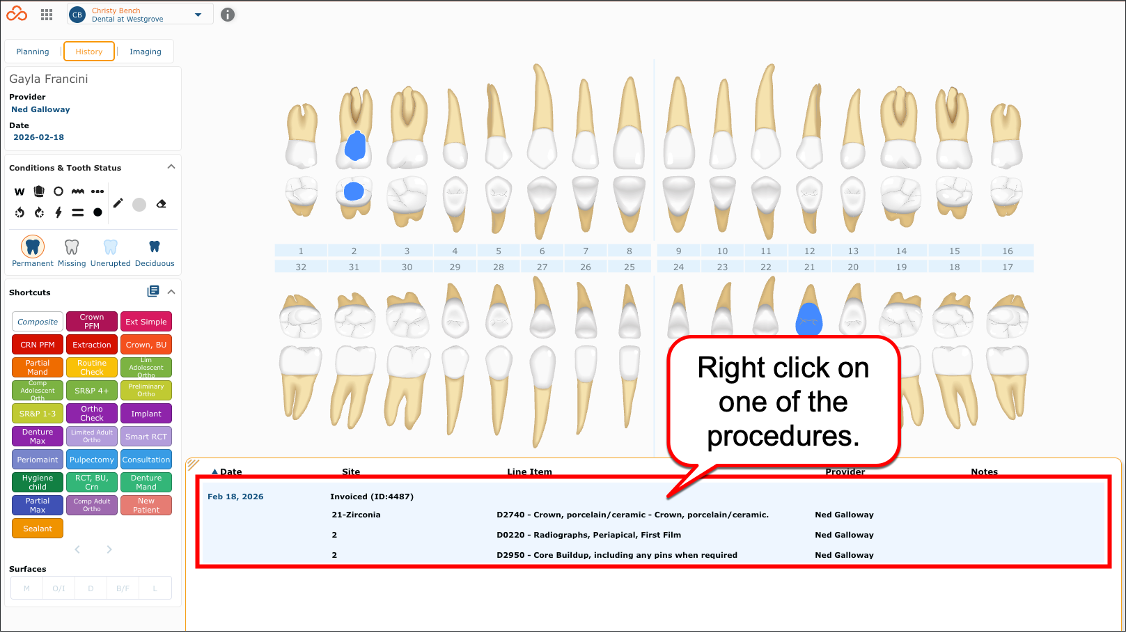 right click visit in hx.png