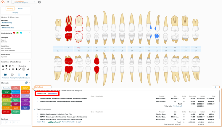 Incomplete Icon in Charting