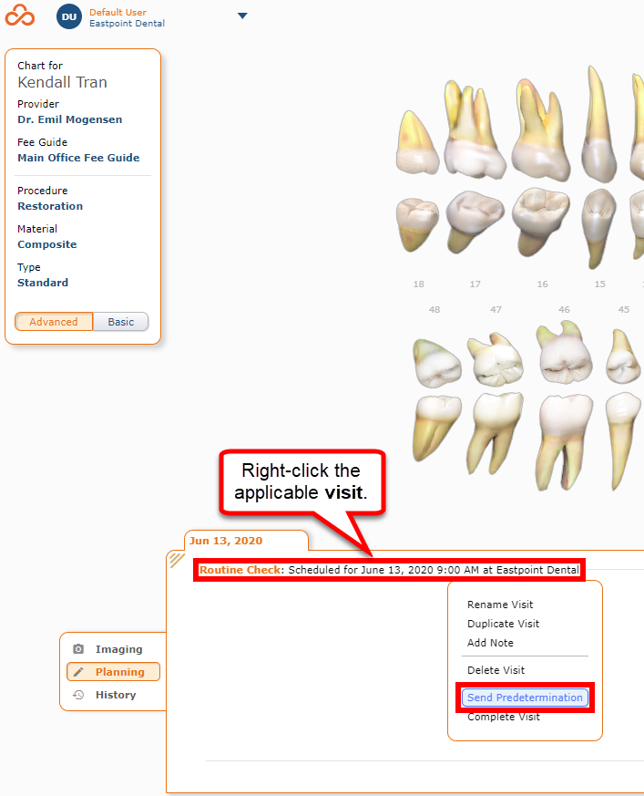 Visit and Send Predetermination