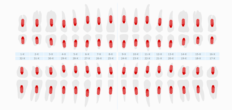 Abutments