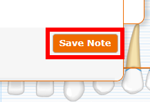 Perio Charting - Save Note.png